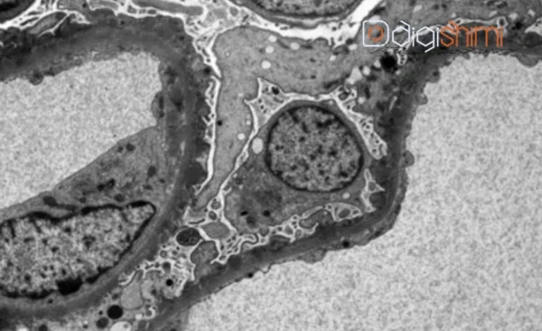 ساختار و اجزای میکروسکوپ های TEM