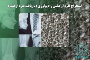 استخراج نقره از عکس رادیولوژی (بازیافت نقره از فیلم)